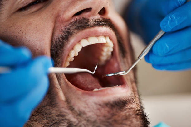 Best Urgent Care for Lost Fillings or Crowns in Benton City, WA